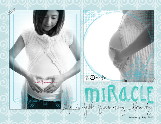 Miracle_at_34wks